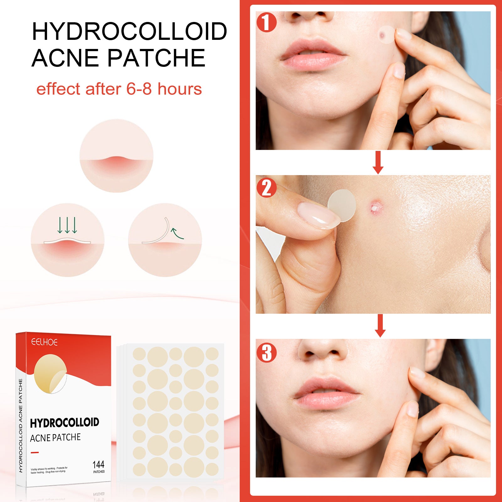 Hydrocolloid Acne Patch Makeup Closed Acne Patch l Ducas Boutique