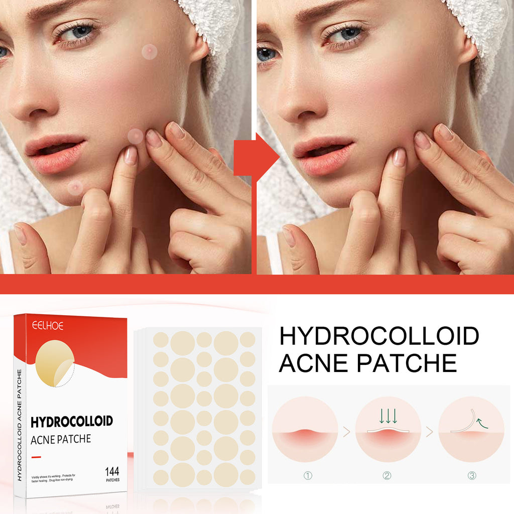 Hydrocolloid Acne Patch Makeup Closed Acne Patch l Ducas Boutique