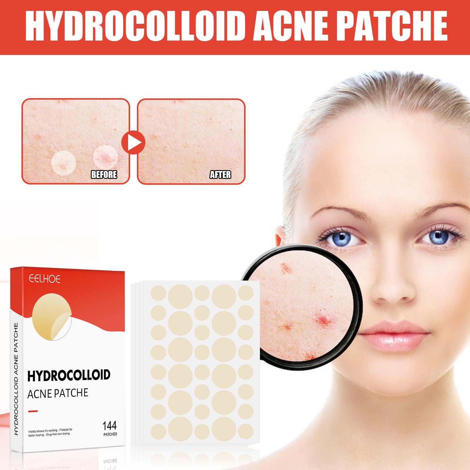 Hydrocolloid Acne Patch Makeup Closed Acne Patch l Ducas Boutique